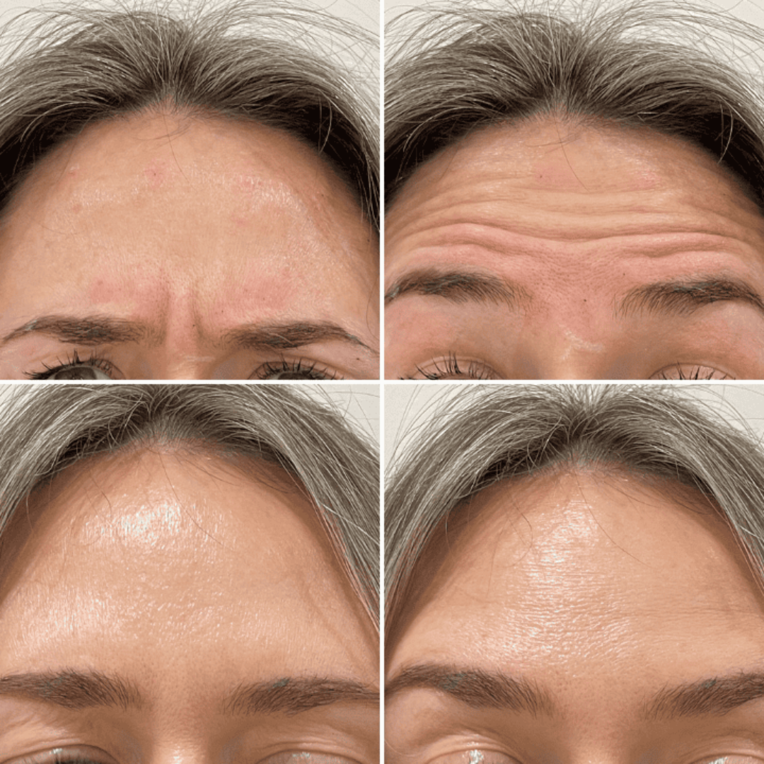 Celimax Retinal Shot Tightening Booster