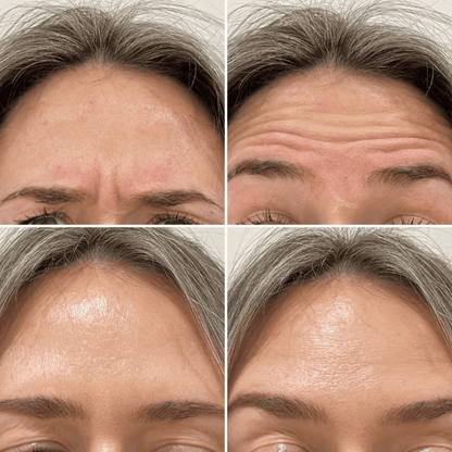 Celimax Retinal Shot Tightening Booster