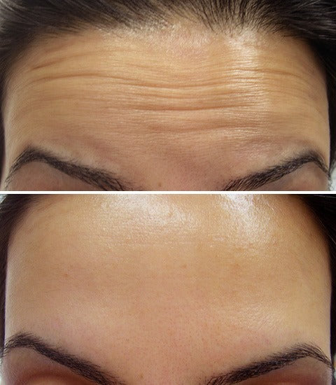 Celimax Retinal Shot Tightening Booster