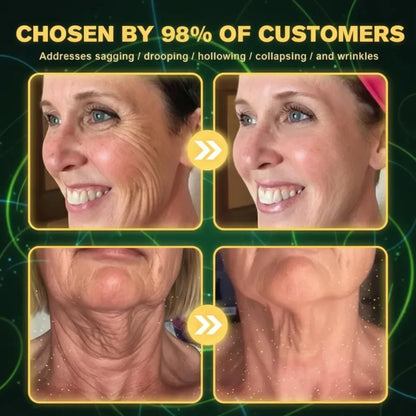 Botox BeeVenom Anti Wrinkle Cream